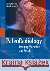 Paleoradiology: Imaging Mummies and Fossils Chhem, R. K. 9783540488323 Not Avail