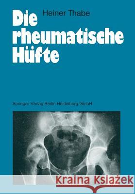 Die Rheumatische Hüfte Thabe, Heiner 9783540500797 Springer