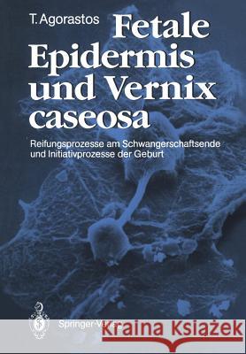 Fetale Epidermis Und Vernix Caseosa: Reifungsprozesse Am Schwangerschaftsende Und Initiativprozesse Der Geburt Agorastos, Theodoros 9783540505105 Not Avail