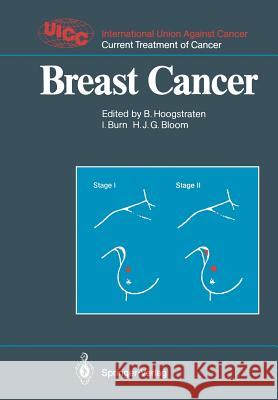 Breast Cancer Barth Hoogstraten Ian Burn H. Julian G. Bloom 9783540505952