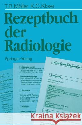 Rezeptbuch Der Radiologie Möller, Torsten B. 9783540505976