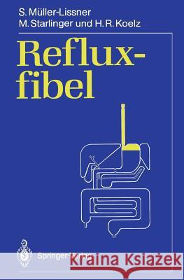 Refluxfibel Stefan Mller-Lissner M. Starlinger H. R. Koelz 9783540510079 Springer