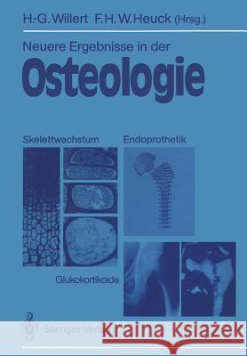 Neuere Ergebnisse in Der Osteologie: Skelettwachstum - Endoprothetik Glukokortikoide Osteologia 4 Willert, Hans-Georg 9783540511755 Springer