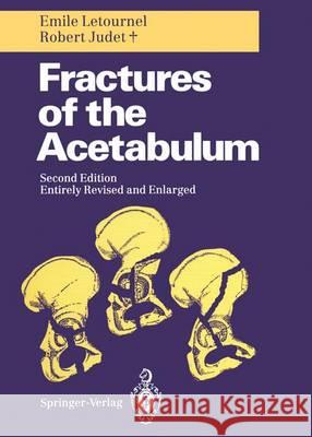 Fractures of the Acetabulum Emile Letournel Robert Judet Reginald A. Elson 9783540521891 Springer