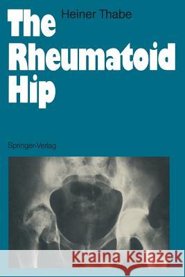 The Rheumatoid Hip Heiner Thabe Julia Roseveare David Roseveare 9783540528845 Springer-Verlag
