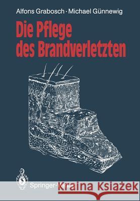 Die Pflege Des Brandverletzten Grabosch, Alfons 9783540533962 Not Avail