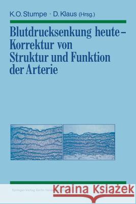 Blutdrucksenkung Heute -- Korrektur Von Struktur Und Funktion Der Arterie Klaus O. Stumpe Dieter Klaus E. Bassenge 9783540534174 Springer