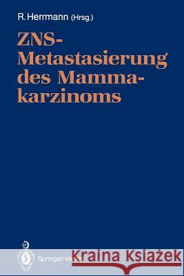 ZNS-Metastasierung des Mammakarzinoms D. Huhn, Richard Herrmann 9783540535751 Springer-Verlag Berlin and Heidelberg GmbH & 
