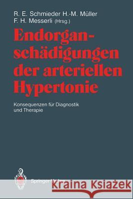 Endorganschädigungen Der Arteriellen Hypertonie -- Konsequenzen Für Diagnostik Und Therapie Schmieder, Roland E. 9783540535812 Not Avail