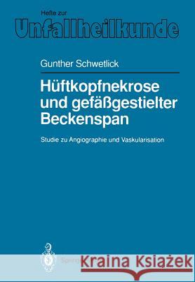 Hüftkopfnekrose Und Gefäßgestielter Beckenspan: Studie Zu Angiographie Und Vaskularisation Weber, U. 9783540538066 Not Avail