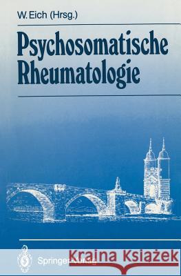 Psychosomatische Rheumatologie Eich, Wolfgang 9783540539155 Not Avail