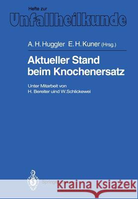 Aktueller Stand Beim Knochenersatz Bereiter, H. 9783540541042