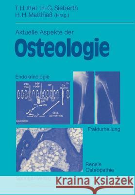 Aktuelle Aspekte Der Osteologie: Endokrinologie, Renale Osteopathie, Frakturheilung Ittel, Thomas H. 9783540542674 Not Avail