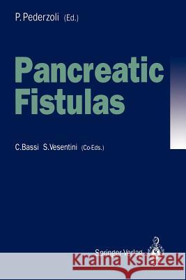 Pancreatic Fistulas Paolo Pederzoli 9783540553380 Springer