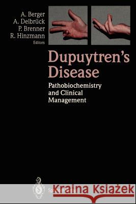 Dupuytren's Disease: Pathobiochemistry and Clinical Management Berger, Alfred 9783540572398 Springer