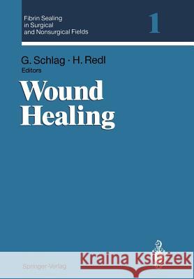 Fibrin Sealing in Surgical and Nonsurgical Fields: Volume 1: Wound Healing Schlag, Günther 9783540575115