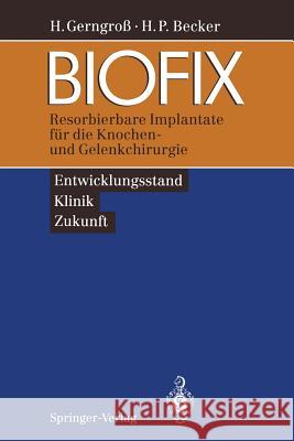 Biofix: Resorbierbare Implantate Für Die Knochen- Und Gelenkchirurgie -- Entwicklungsstand, Klinik, Zukunft -- Gerngroß, Heinz 9783540576655 Not Avail