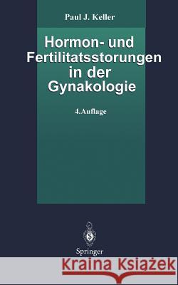 Hormon- Und Fertilitätsstörungen in Der Gynäkologie Keller, Paul J. 9783540584131 Springer