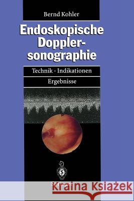 Endoskopische Dopplersonographie: Technik - Indikationen - Ergebnisse Kohler, Bernd M. 9783540587743