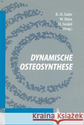 Dynamische Osteosynthese Gahr, R. H. 9783540589747 Not Avail