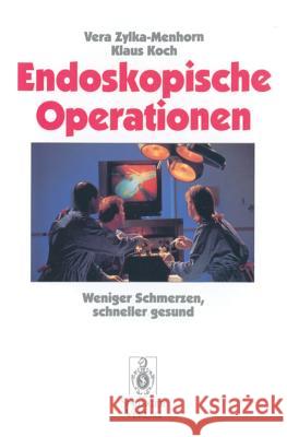 Endoskopische Operationen: Weniger Schmerzen, schneller gesund Vera Zylka-Menhorn, Klaus Koch 9783540593270