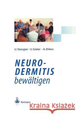 Neurodermitis Bewältigen: Verhaltenstherapie Dermatologische Schulung Autogenes Training Stangier, Ulrich 9783540603863 Not Avail