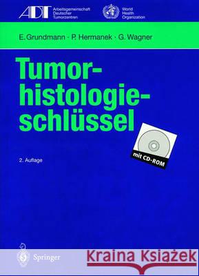 Tumor-Histologieschlüssel: Empfehlungen Zur Aktuellen Klassifikation Und Kodierung Der Neoplasien Auf Der Grundlage Der ICD-O Grundmann, E. 9783540610052 Springer