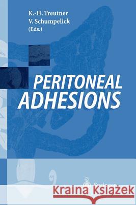 Peritoneal Adhesions K. H. Treutner Karl-Heinz Treutner Karl-Heinz Treutner 9783540611929 Springer