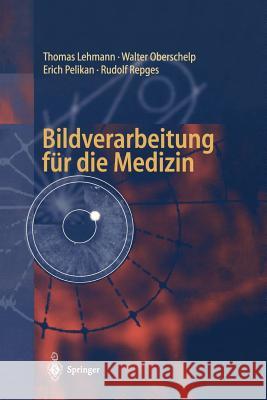 Bildverarbeitung Für Die Medizin: Grundlagen, Modelle, Methoden, Anwendungen Lehmann, Thomas 9783540614586