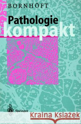 Pathologie Kompakt Bornhöft, Gudrun 9783540620822