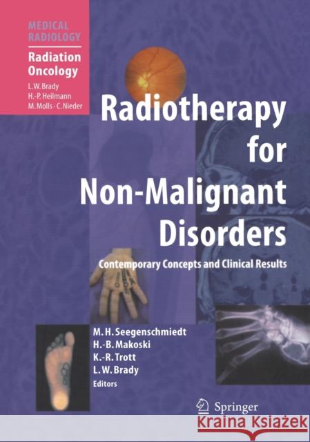 Radiotherapy for Non-Malignant Disorders Makoski                                  H. M. Seegenschmiedt 9783540625506 Springer