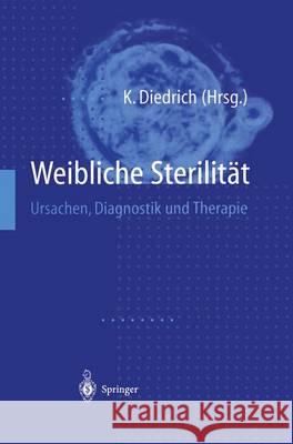 Weibliche Sterilitat: Ursachen, Diagnostik Und Therapie Klaus Diedrich 9783540629627 Springer