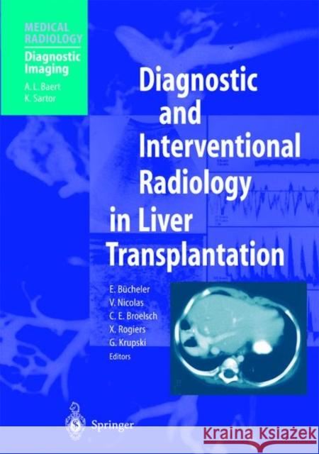 Diagnostic and Interventional Radiology in Liver Transplantation Rainer Greger E. Bucheler V. Nicolas 9783540633112 Springer