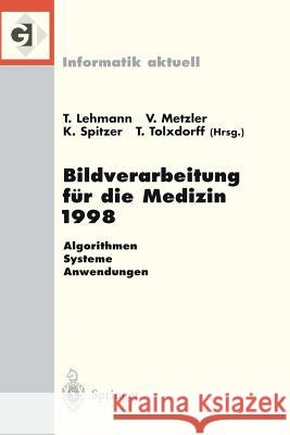 Bildverarbeitung Für Die Medizin 1998: Algorithmen -- Systeme -- Anwendungen Proceedings Des Workshops Am 26. Und 27. März 1998 in Aachen Lehmann, Thomas 9783540638858 Springer