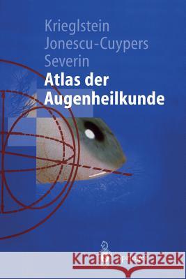 Atlas Der Augenheilkunde Krieglstein, Günter K. 9783540640011 Springer