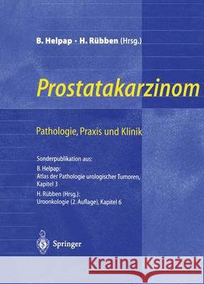 Prostatakarzinom -- Pathologie, Praxis Und Klinik: Pathologie, Praxis Und Klinik Helpap, Burkhard 9783540640066