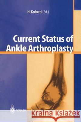 Current Status of Ankle Arthroplasty H. Kofoed Hakon Kofoed 9783540646532 Springer
