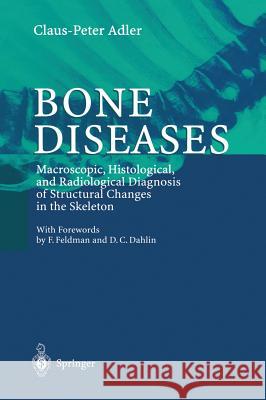 Bone Diseases: Macroscopic, Histological, and Radiological Diagnosis of Structural Changes in the Skeleton Steel, F. 9783540650614 Springer Berlin Heidelberg