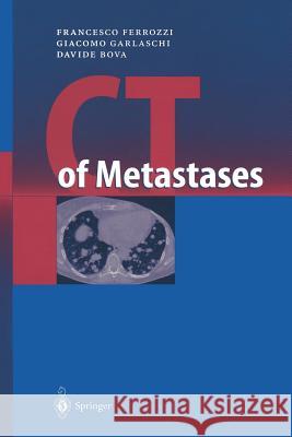 CT of Metastases F. Ferrozzi Francesco Ferrozzi Giacomo Garlaschi 9783540650973 Springer