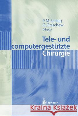 Tele- Und Computergestützte Chirurgie Schlag, Peter M. 9783540653424