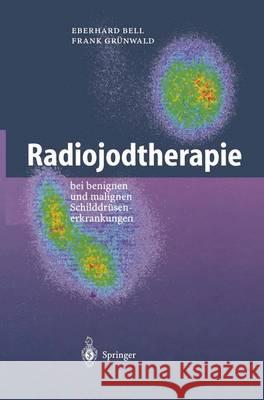 Radiojodtherapie: Bei Benignen Und Malignen Schilddra1/4senerkrankungen Bell, Eberhard Grünwald, Frank  9783540659136 Springer, Berlin