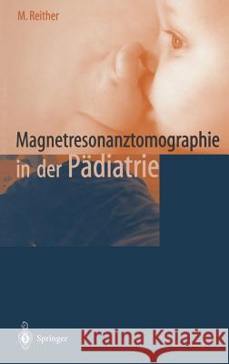 Magnetresonanztomographie in Der Padiatrie Reither, M. 9783540663041 Springer