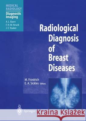 Radiological Diagnosis of Breast Diseases Michael Friedrich Edward A. Sickles M. Friedrich 9783540663393 Springer