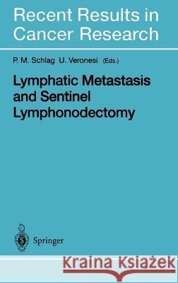 Lymphatic Metastasis and Sentinel Lymphonodectomy P. M. Schlag U. Veronesi P. M. Schlag 9783540666424 Springer Berlin Heidelberg