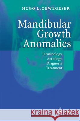Mandibular Growth Anomalies: Terminology - Aetiology Diagnosis - Treatment Tessier, P. 9783540672142 Springer Berlin Heidelberg