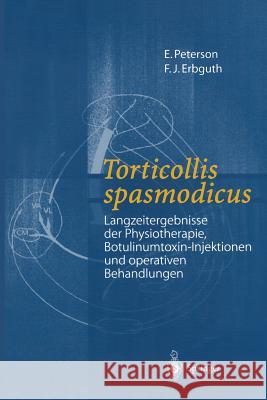Torticollis Spasmodicus: Langzeitergebnisse Der Physiotherapie, Botulinumtoxin-Injektionen Und Operativen Behandlungen Peterson, E. 9783540674481 Springer