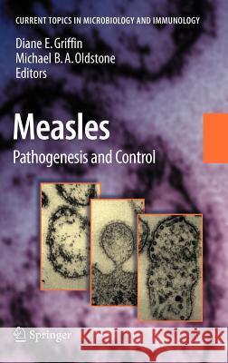Measles: Pathogenesis and Control Griffin, Diane E. 9783540706168 Springer