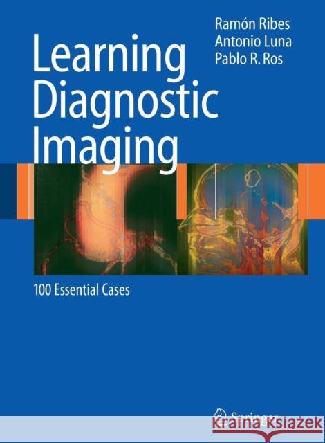 Learning Diagnostic Imaging: 100 Essential Cases Ribes, Ramón 9783540712060 Not Avail