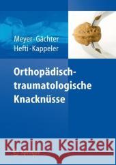 Orthopädisch-Traumatologische Knacknüsse Meyer, Rainer-Peter 9783540714798