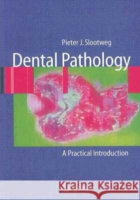 Dental Pathology: A Practical Introduction Pieter J. Slootweg 9783540716907 Springer